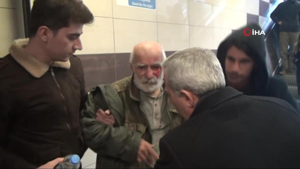 Ünlü oyuncu Taksimde yürüyen merdivenden düşerek yaralandı