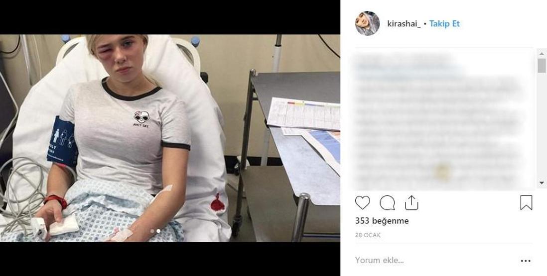 Modellik hayali kuruyordu, hayatı kabusa döndü