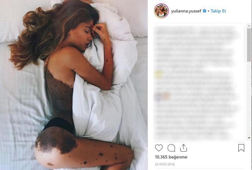 Yıllarca Dalmaçyalı diye alay edildi, şimdi aranılan modeller arasında
