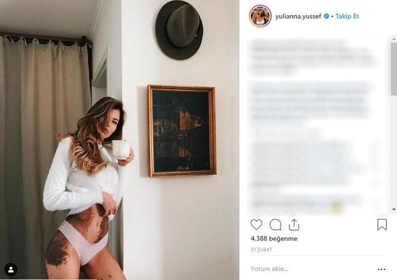 Yıllarca Dalmaçyalı diye alay edildi, şimdi aranılan modeller arasında