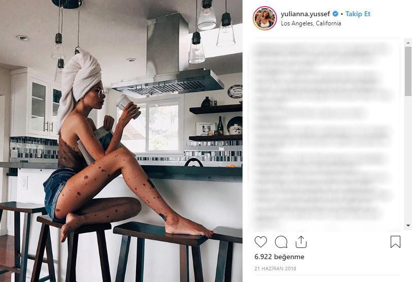 Yıllarca Dalmaçyalı diye alay edildi, şimdi aranılan modeller arasında