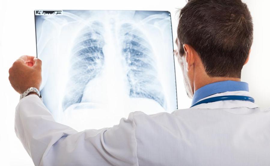 Pulmoner emboli nedir Belirtileri nelerdir