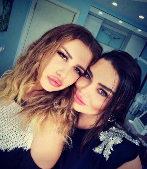 Melis Buse Betkayanın estetikli hali şaşırttı