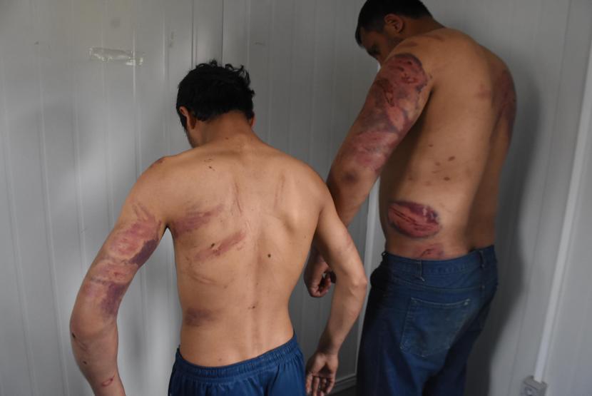 Yunan polisi Pakistanlı göçmenleri dövüp Türkiyeye gönderdi iddiası