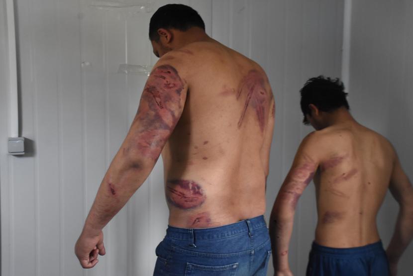 Yunan polisi Pakistanlı göçmenleri dövüp Türkiyeye gönderdi iddiası