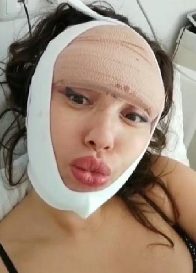 Estetik faciası yaşamıştı 22nci ameliyatını oldu