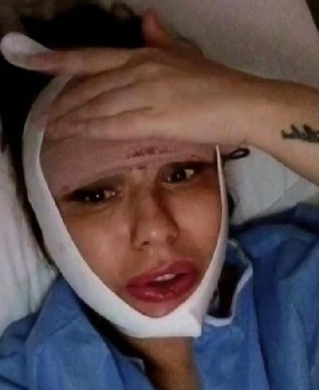 Estetik faciası yaşamıştı 22nci ameliyatını oldu