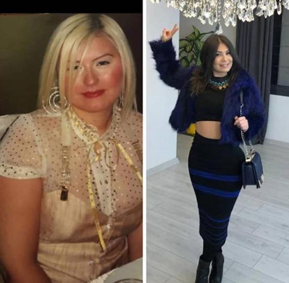 Estetik faciası yaşamıştı 22nci ameliyatını oldu