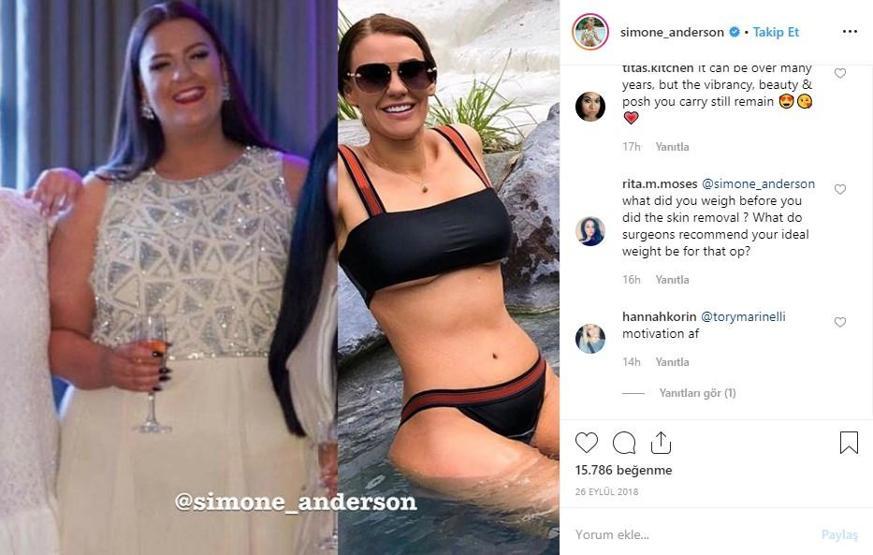 12 ayda 90 kilo verdi... Instagram fenomeninin son halini görenler tanıyamıyor