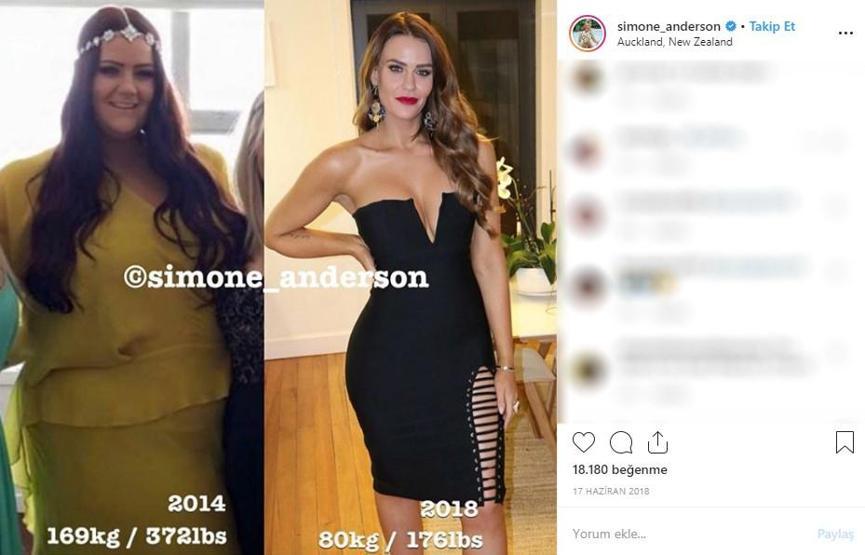 12 ayda 90 kilo verdi... Instagram fenomeninin son halini görenler tanıyamıyor