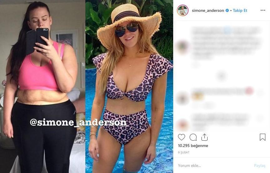 12 ayda 90 kilo verdi... Instagram fenomeninin son halini görenler tanıyamıyor