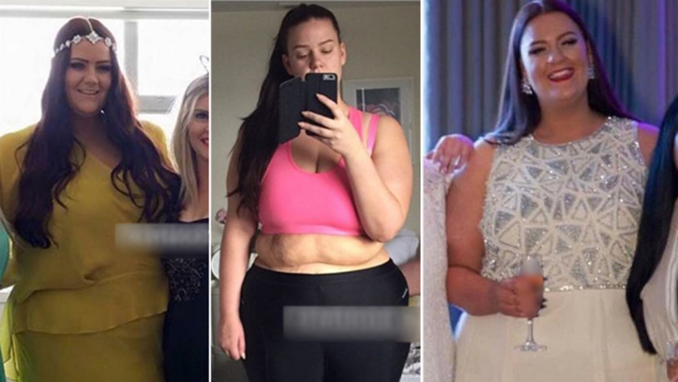 12 ayda 90 kilo verdi... Instagram fenomeninin son halini görenler tanıyamıyor