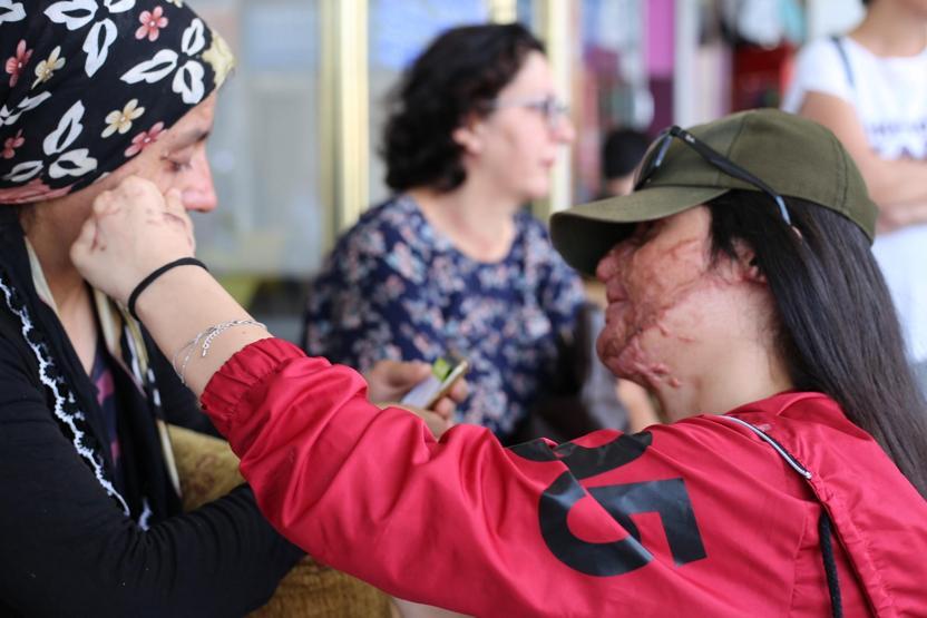 Berfin yeni yüzü için gözyaşları içinde yola çıktı