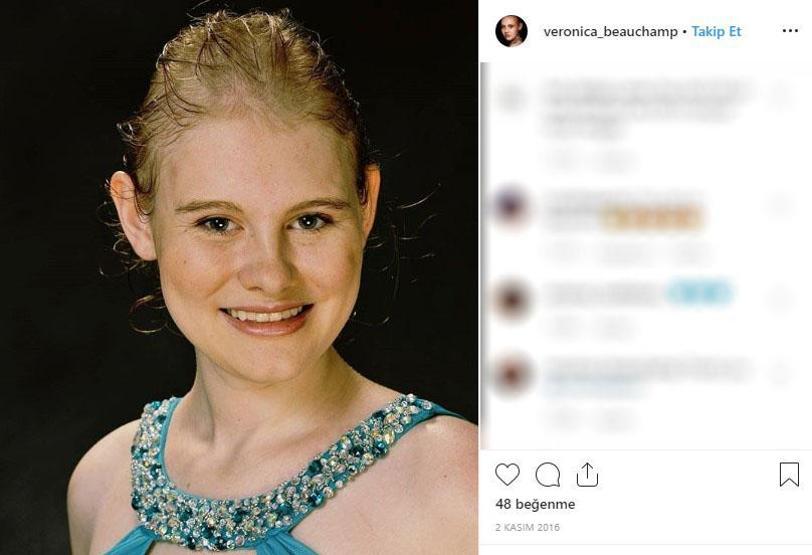 Kusursuz hayatı var gibi görünüyor ama... Genç model hastalığını açıkladı