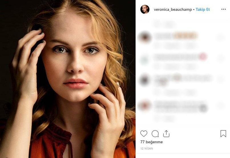 Kusursuz hayatı var gibi görünüyor ama... Genç model hastalığını açıkladı