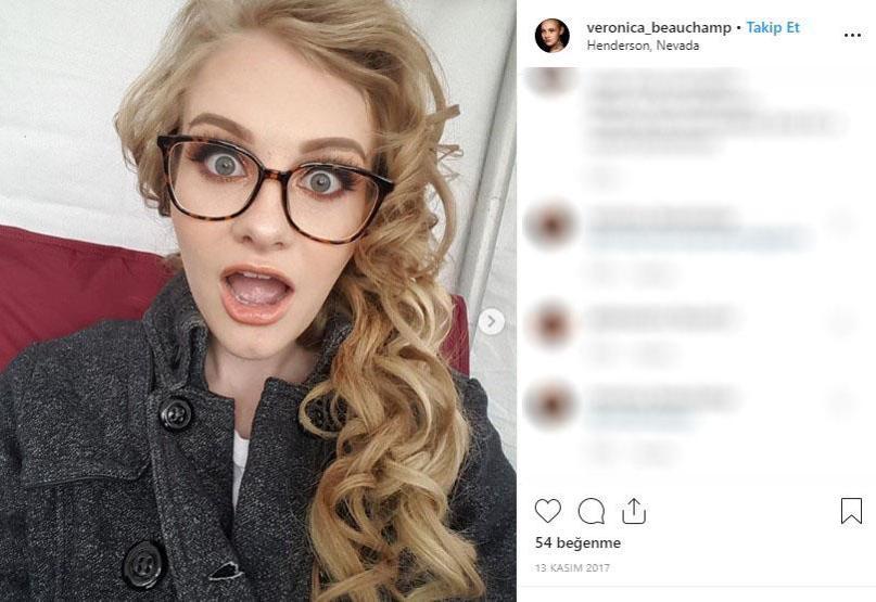 Kusursuz hayatı var gibi görünüyor ama... Genç model hastalığını açıkladı