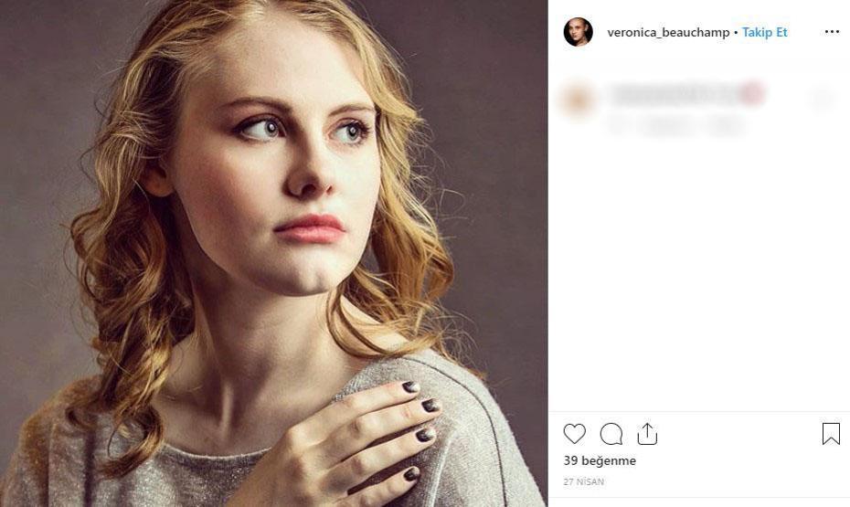 Kusursuz hayatı var gibi görünüyor ama... Genç model hastalığını açıkladı