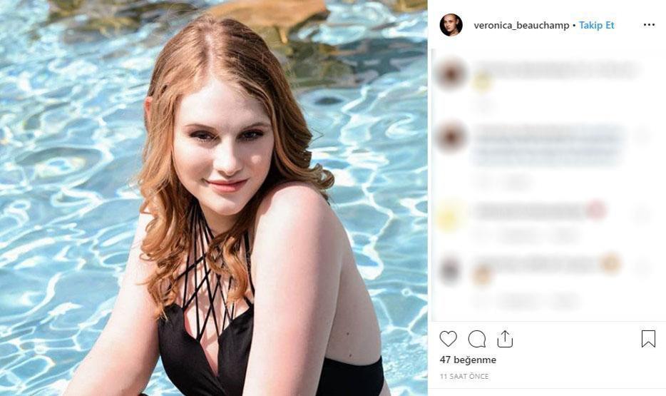 Kusursuz hayatı var gibi görünüyor ama... Genç model hastalığını açıkladı