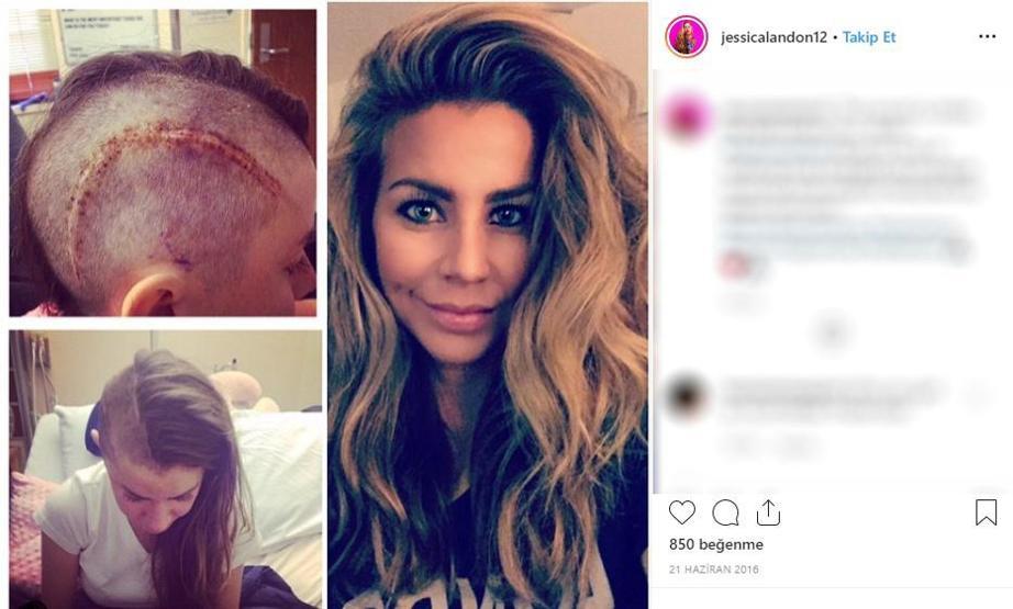Hayatta istediği her şeye sahipti... Ünlü modelin cildi bu hale geldi, ölümden döndü