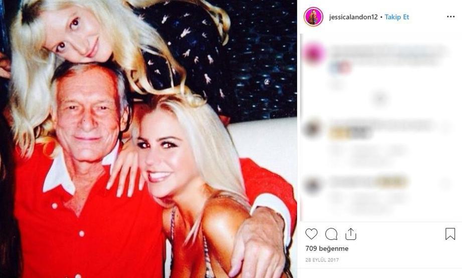 Hayatta istediği her şeye sahipti... Ünlü modelin cildi bu hale geldi, ölümden döndü