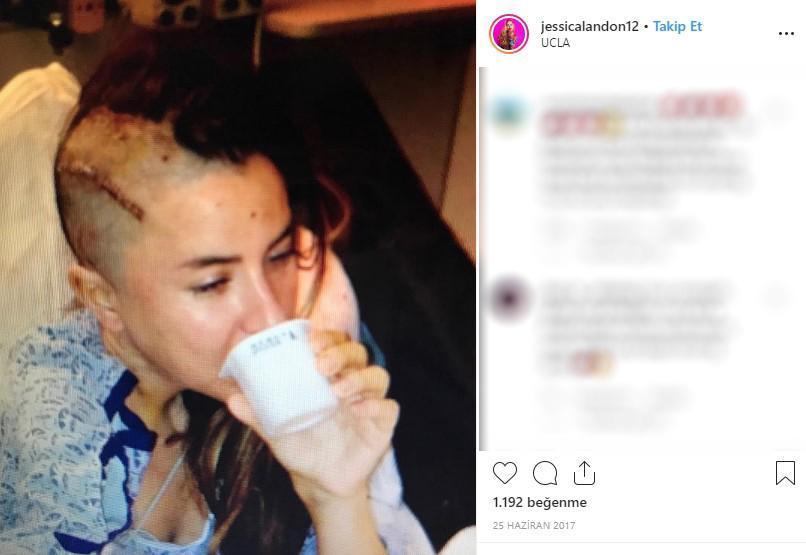 Hayatta istediği her şeye sahipti... Ünlü modelin cildi bu hale geldi, ölümden döndü