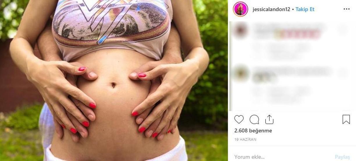 Hayatta istediği her şeye sahipti... Ünlü modelin cildi bu hale geldi, ölümden döndü