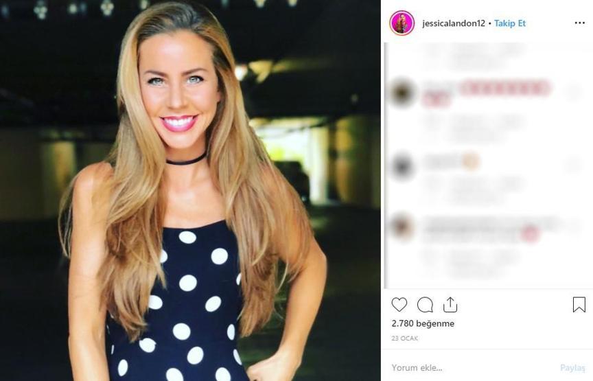 Hayatta istediği her şeye sahipti... Ünlü modelin cildi bu hale geldi, ölümden döndü