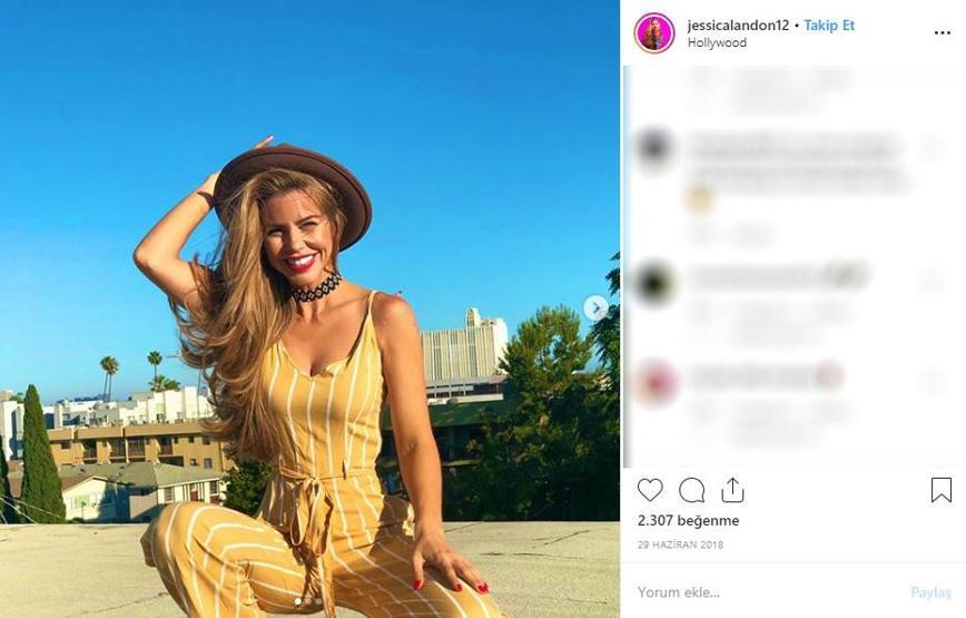 Hayatta istediği her şeye sahipti... Ünlü modelin cildi bu hale geldi, ölümden döndü
