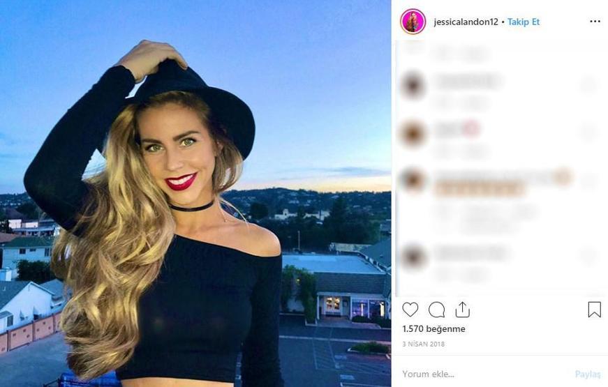Hayatta istediği her şeye sahipti... Ünlü modelin cildi bu hale geldi, ölümden döndü