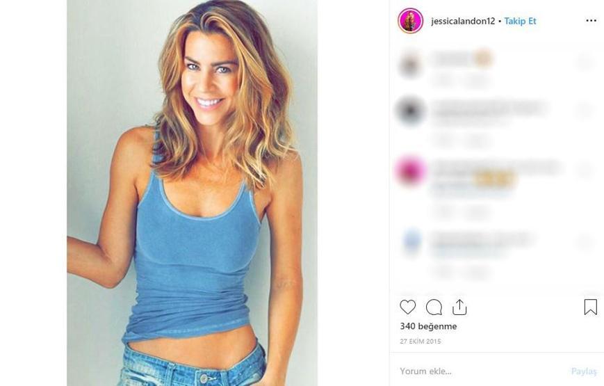 Hayatta istediği her şeye sahipti... Ünlü modelin cildi bu hale geldi, ölümden döndü