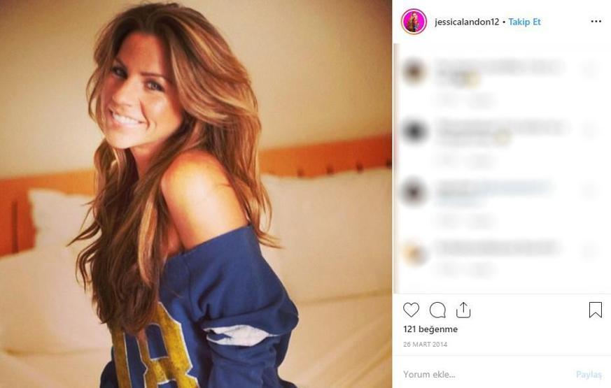 Hayatta istediği her şeye sahipti... Ünlü modelin cildi bu hale geldi, ölümden döndü