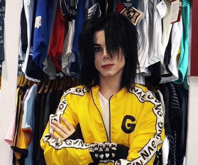 Michael Jacksona benzemek istedi bu hale geldi Eski halini görenler ise inanamıyor