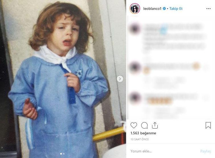 Michael Jacksona benzemek istedi bu hale geldi Eski halini görenler ise inanamıyor