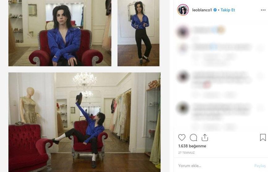 Michael Jacksona benzemek istedi bu hale geldi Eski halini görenler ise inanamıyor