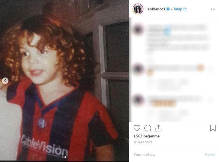 Michael Jacksona benzemek istedi bu hale geldi Eski halini görenler ise inanamıyor