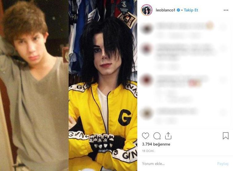 Michael Jacksona benzemek istedi bu hale geldi Eski halini görenler ise inanamıyor