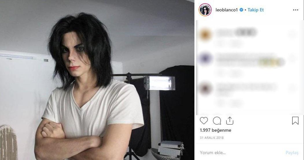 Michael Jacksona benzemek istedi bu hale geldi Eski halini görenler ise inanamıyor