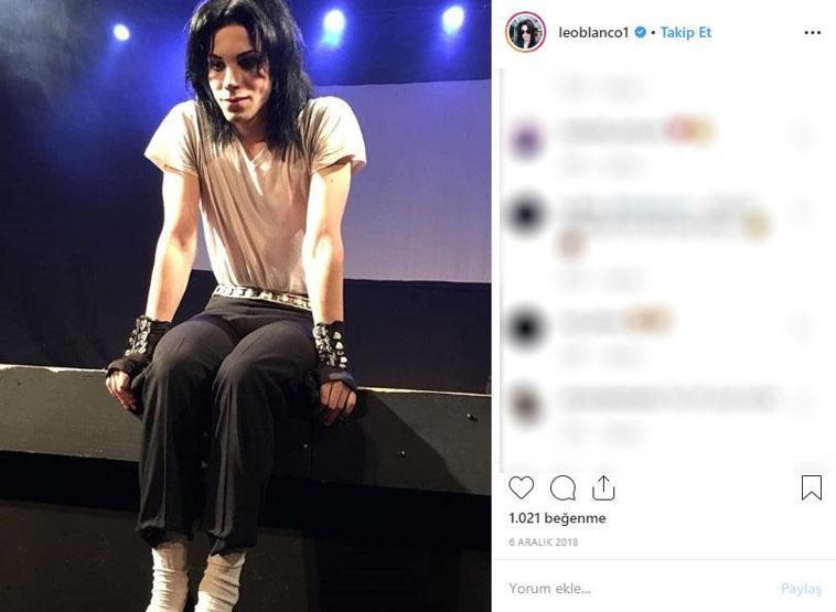Michael Jacksona benzemek istedi bu hale geldi Eski halini görenler ise inanamıyor