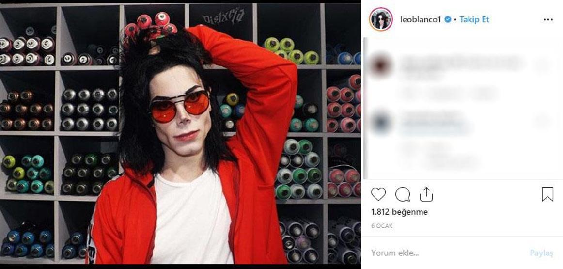 Michael Jacksona benzemek istedi bu hale geldi Eski halini görenler ise inanamıyor