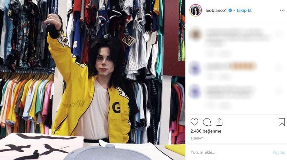 Michael Jacksona benzemek istedi bu hale geldi Eski halini görenler ise inanamıyor