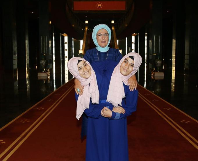 Siyam ikizleri Cumhurbaşkanlığı Külliyesi’nde