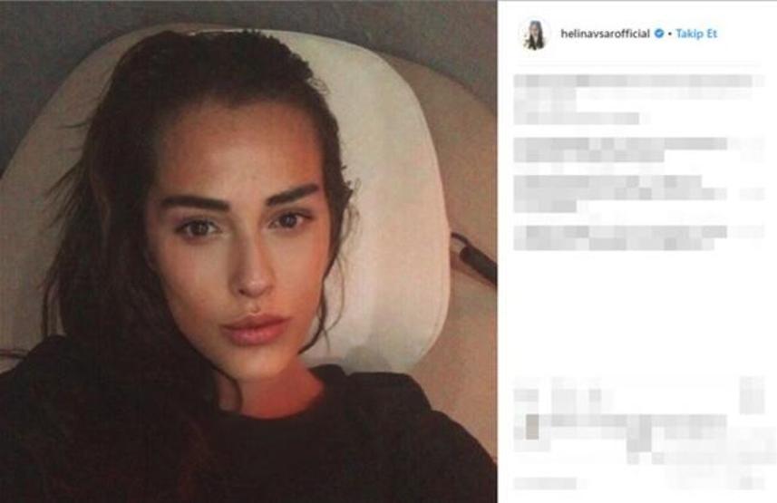Helin Avşarın son hali şaşırttı