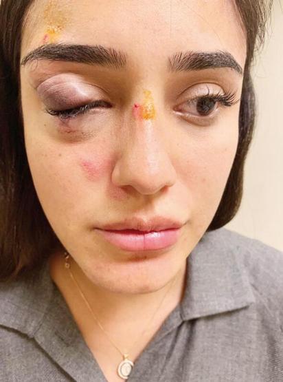 Sevgilisi Ceren Kaplakarslanı darp etmişti... Eski eşten ilk yorum