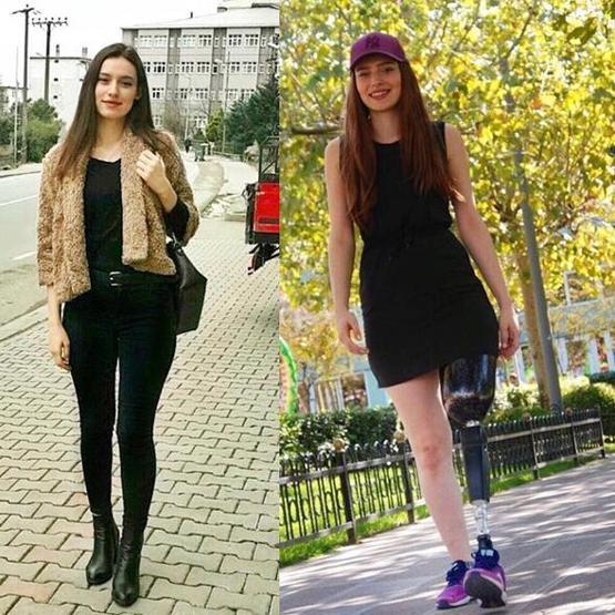 Neslican Tay hayatını kaybetti: Hep bir melek olarak kalacaksın