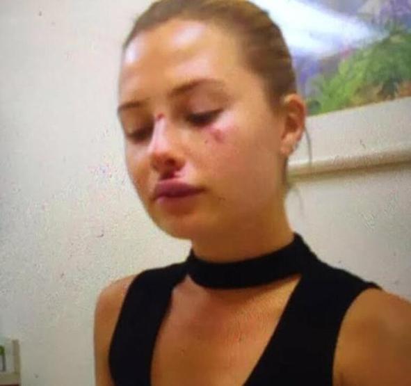 Serdar Ortaçın eski eşi Chloe Loughnan konuştu: Keşke kocam hastaneye gelseydi