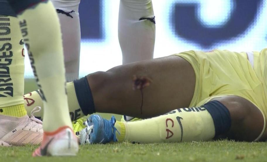 Giovani dos Santos korkunç bir sakatlık geçirdi