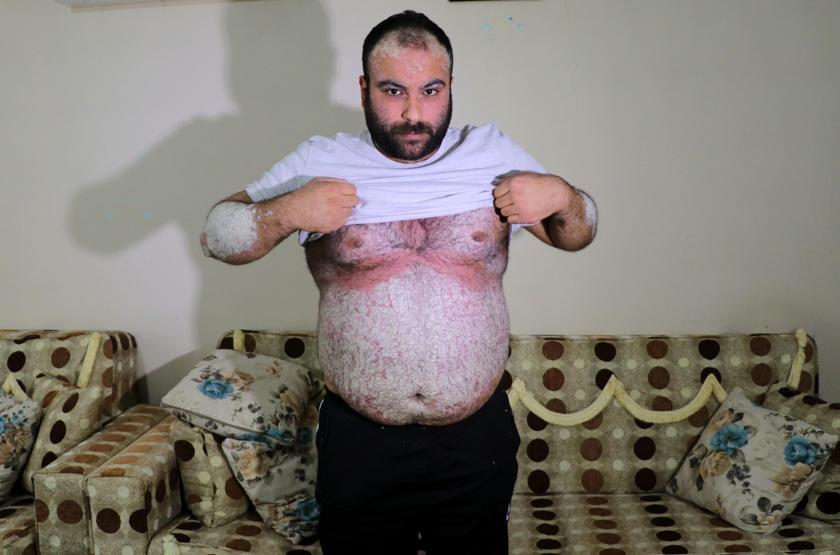 Kimse korkmasın diye dışarı çıkmıyor