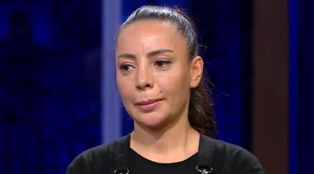 MasterChef Suna estetik yaptırdı