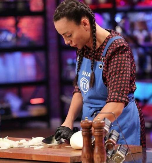 MasterChef Suna estetik yaptırdı