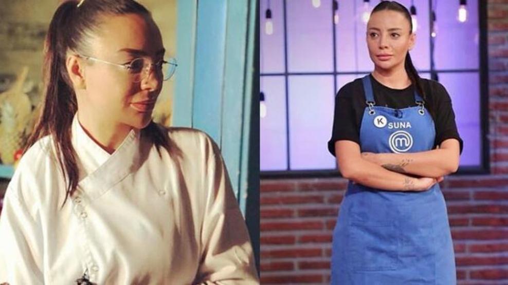 MasterChef Suna estetik yaptırdı